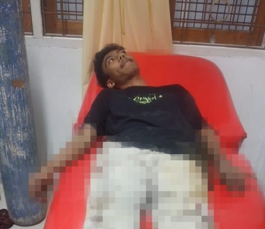 Mahasiswa di Kendari Dikeroyok OTK di BTN Bumi Praja, Polisi Buru Pelaku